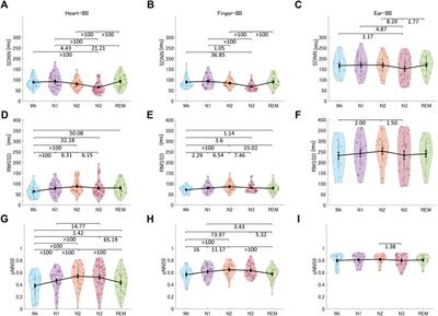 Peripheral blood flow estimated by laser doppler flowmetry provides additional information about sleep state beyond that provided by pulse rate variability